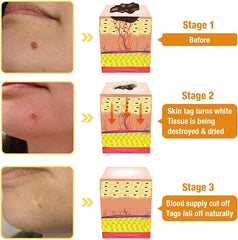 Bee Venom Cream – Natural Relief &amp; Comfort For All Skin Types (2PCS)